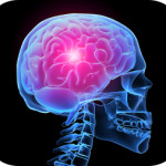 Headaches_Migraines481